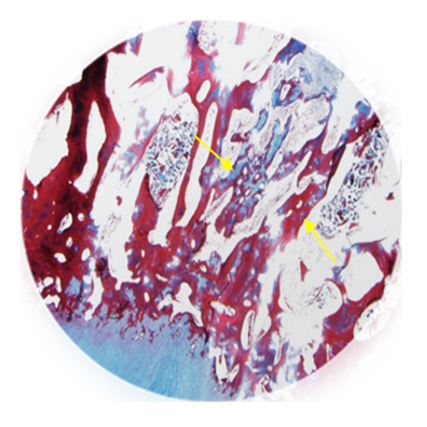 Bone & Cartilage Regeneration