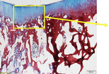 CoreTlage 4.5 months