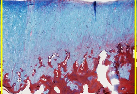 CoreTlage 4.5 months