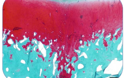 Safranin O/fast Green; 100x orig. mag.