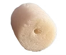 Coral Based Articular Cartilage Regeneration4